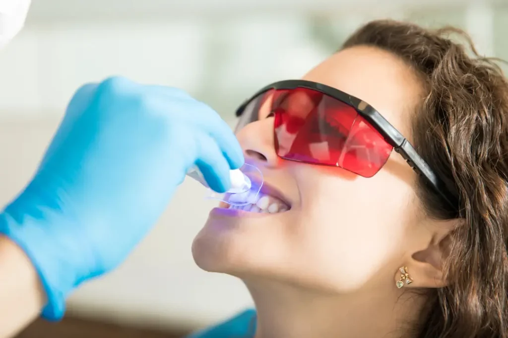 Blanqueamiento dental en Dos Hermanas - Recobra la blancura de tu sonrisa