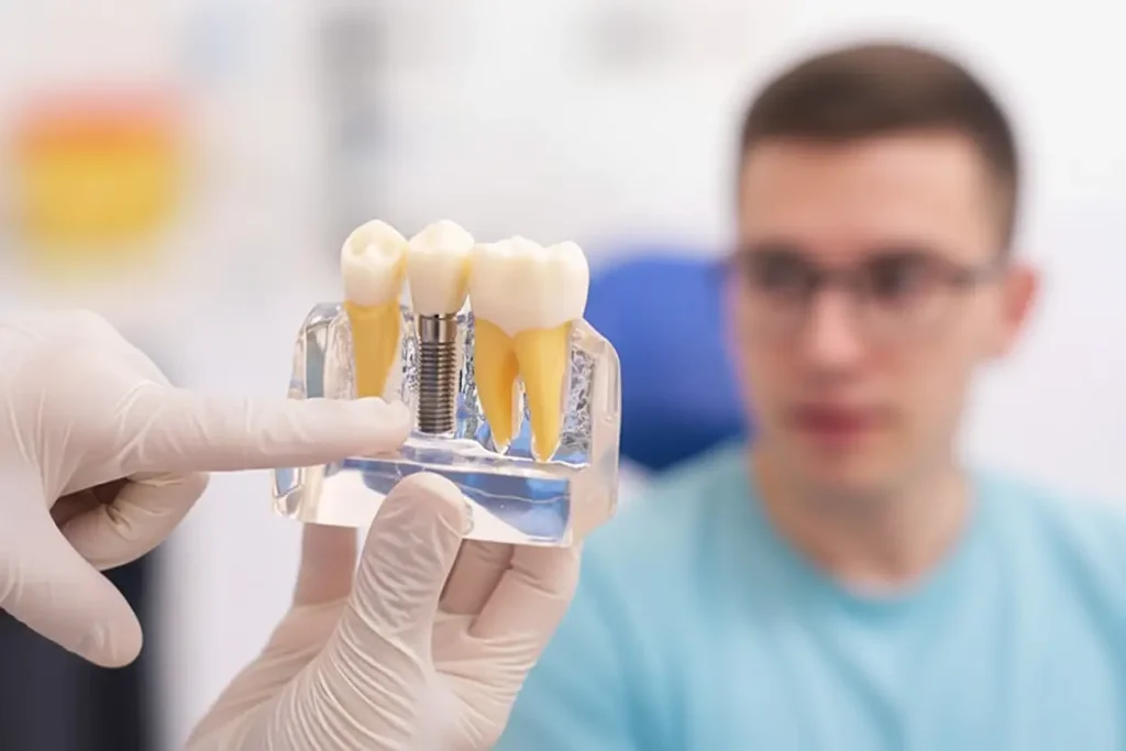 implante-en-un-dia-sevilla