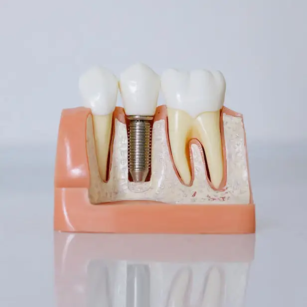 Implantes dentales en Sevilla - Recupera tu sonrisa con Orthodontic