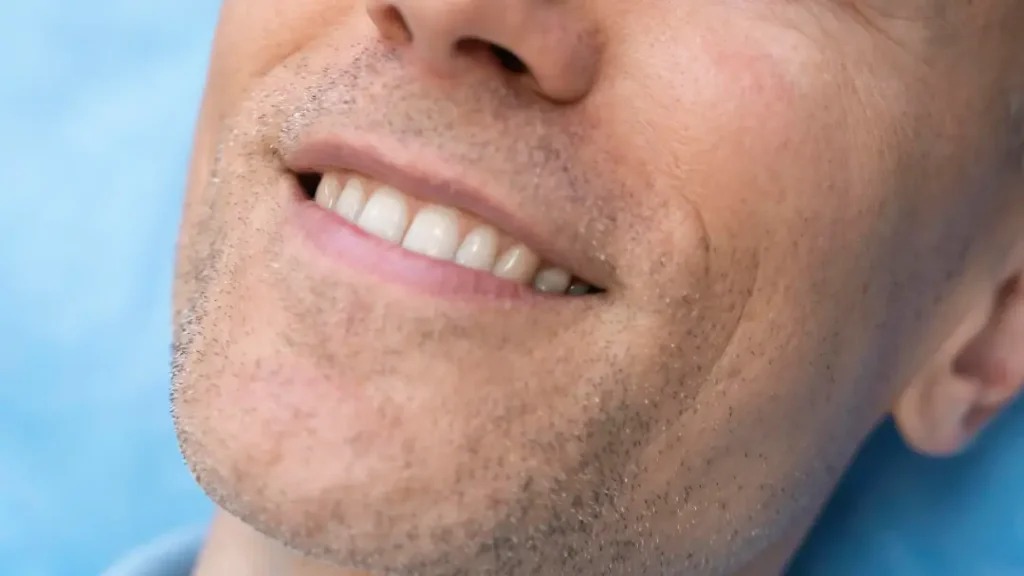 estetica-implantes-dentales-sevilla