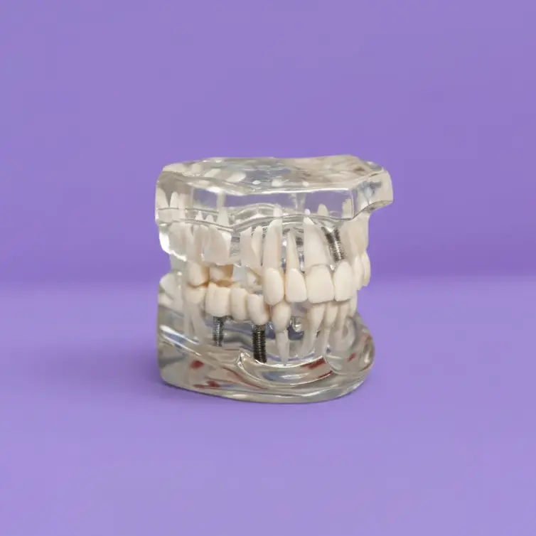 Implantes dentales en un día en Sevilla