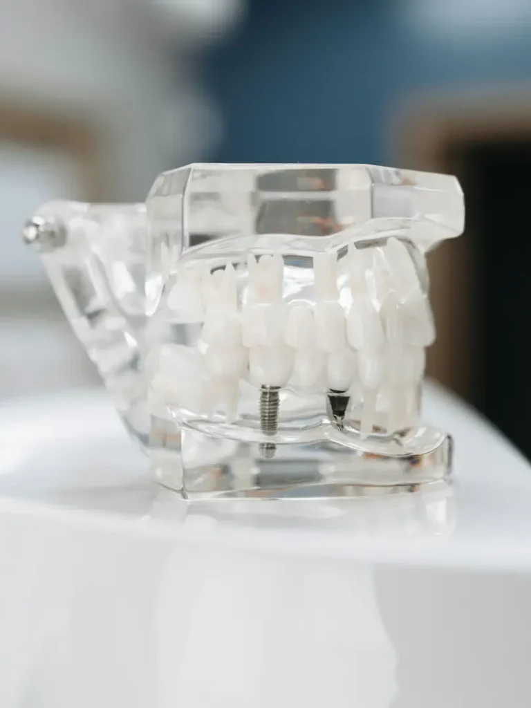 implantes-sevilla-dos-hermanas