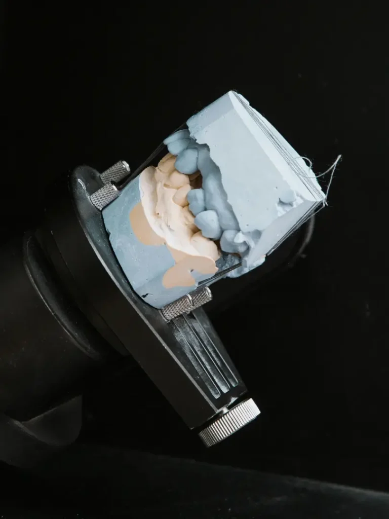 tecnologia-implantes-sin-cirugia-sevilla