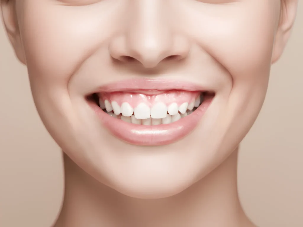 antes--tratamiento-encias-dos-hermanas