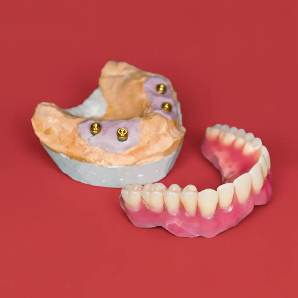 Implantes All-on-6 en Dos Hermanas