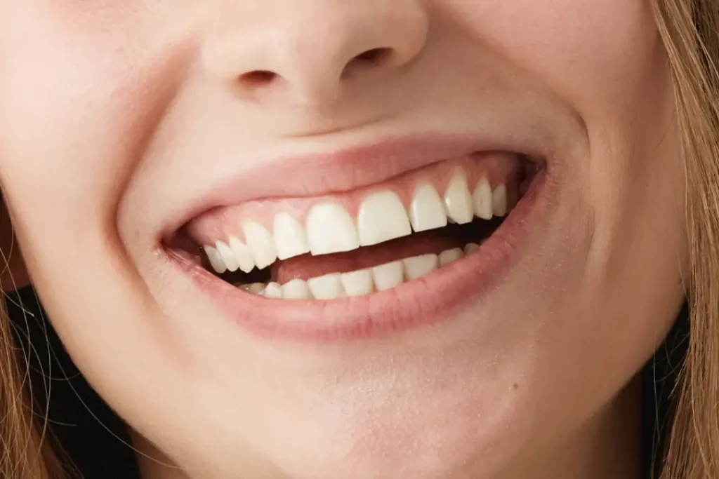 personalizacion-encias-sevilla