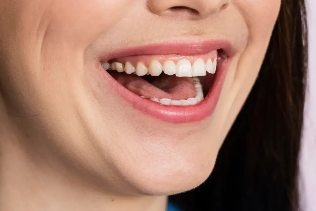 recuperacion-tratamiento-encias-sevilla