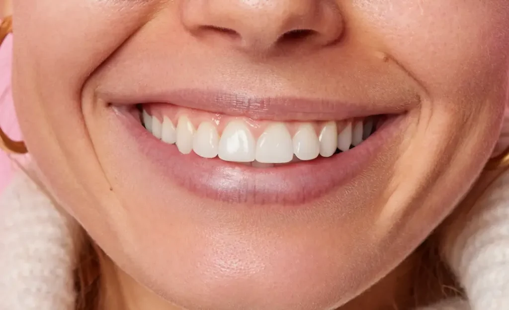 Resultados del tratamiento para halitosis en Dos Hermanas