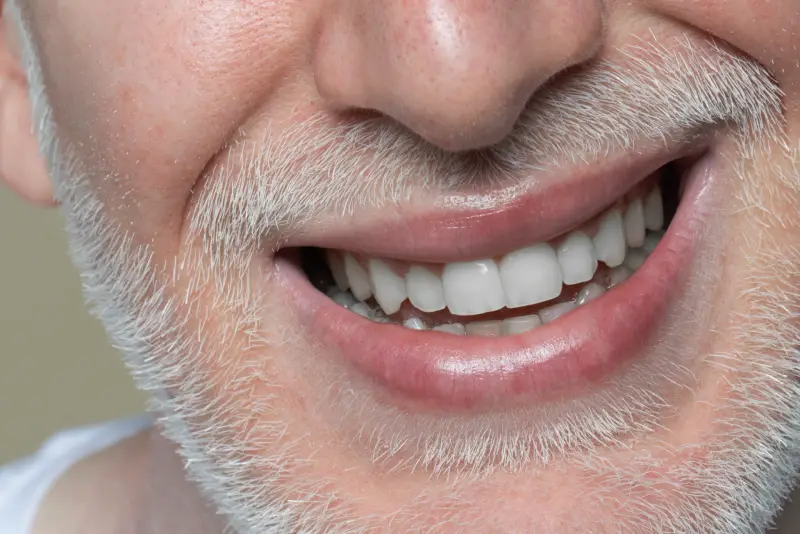 seguridad-implantes-all-on-6-dos-hermanas