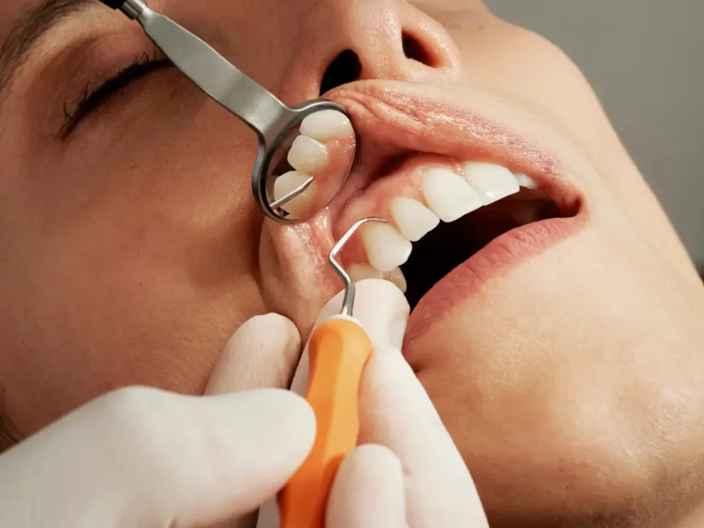Tratamiento de periodoncia en Sevilla
